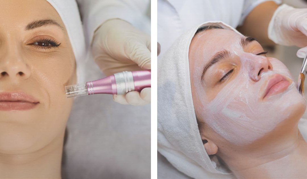 ¿Dermapen o Higiene Tradicional? El secreto para una piel renovada