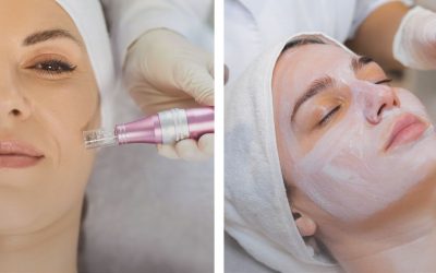 ¿Dermapen o Higiene Tradicional? El secreto para una piel renovada